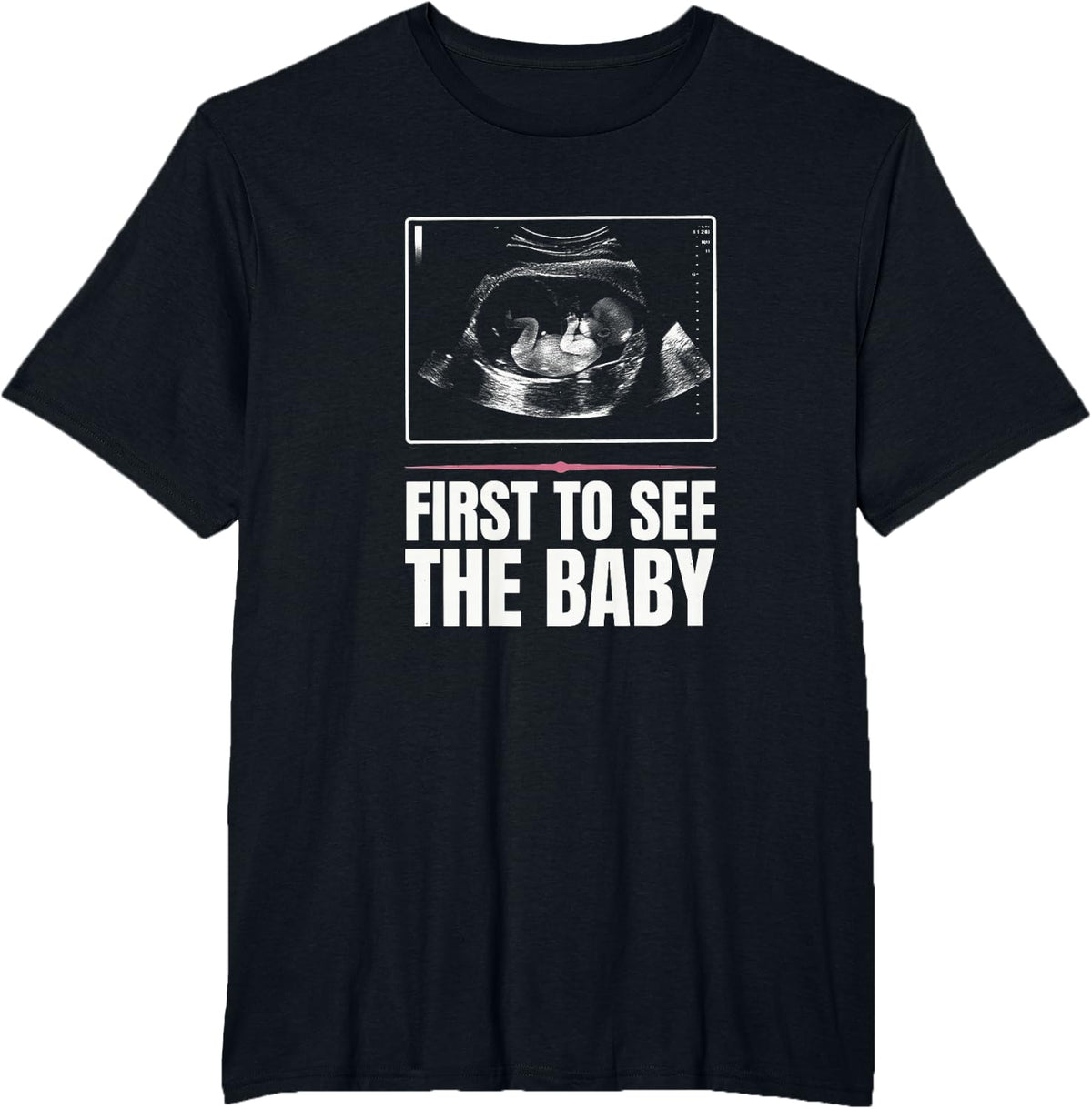 Sonographer Baby Ultrasound T-Shirt - Black